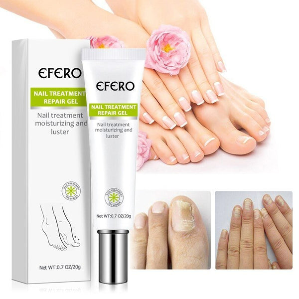 NailRecovery™ | Snel en effectief resultaat!