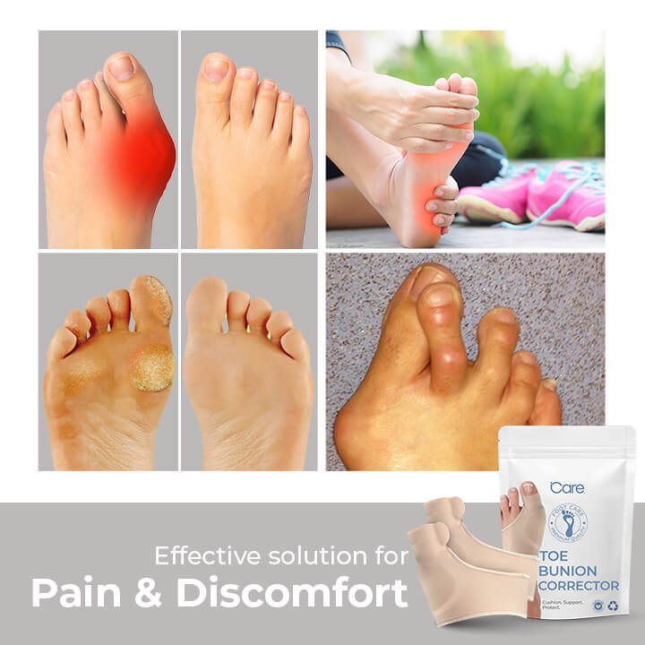 Hallux Valgus Teen Corrector | Orthopedische Bunion Spalk | Zachte Gel | 1 Paar