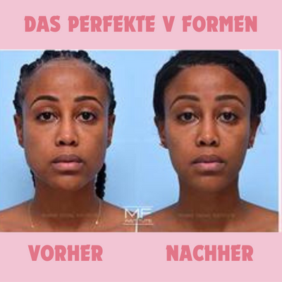 GezichtStraler™ Gezichtsserum | Verstevigend & Verjongend Effect | Anti-Aging Hydratatie voor Stralende Huid