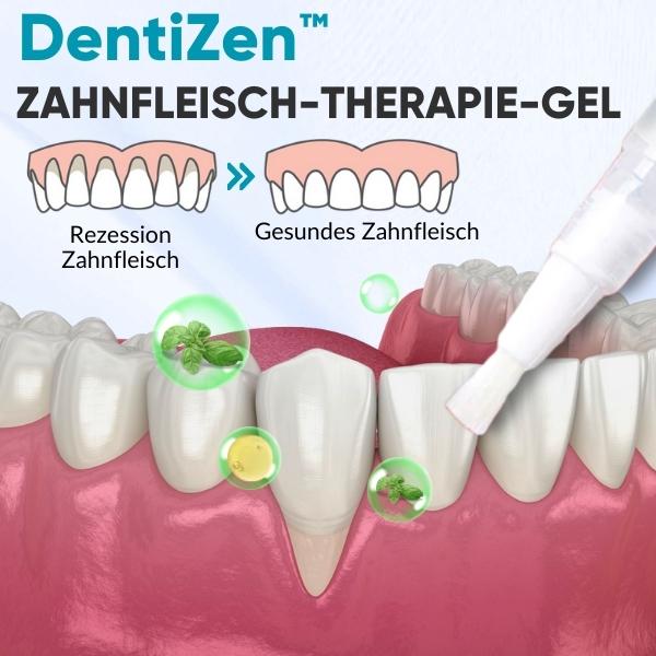 Smile™ | tandvleestherapie gel