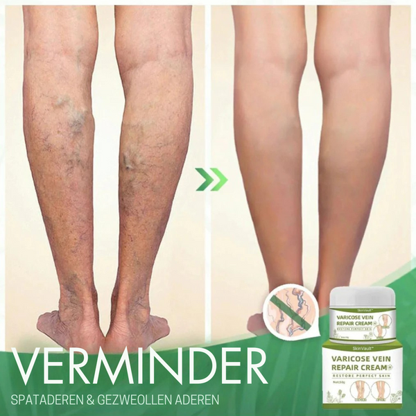 VasculaireVerlichting™ Vernieuw adergezondheid in slechts 2 weken