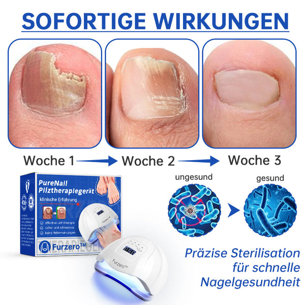 SchimmelVrij™ Vernieuw de nagelgezondheid in slechts enkele weken