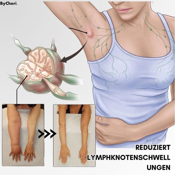 (50% KORTING) LymphWave™ Pak Hardnekkig Vet Aan Met Lymfestimulatie