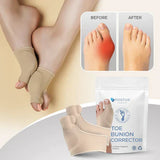 Hallux Valgus Teen Corrector | Orthopedische Bunion Spalk | Zachte Gel | 1 Paar