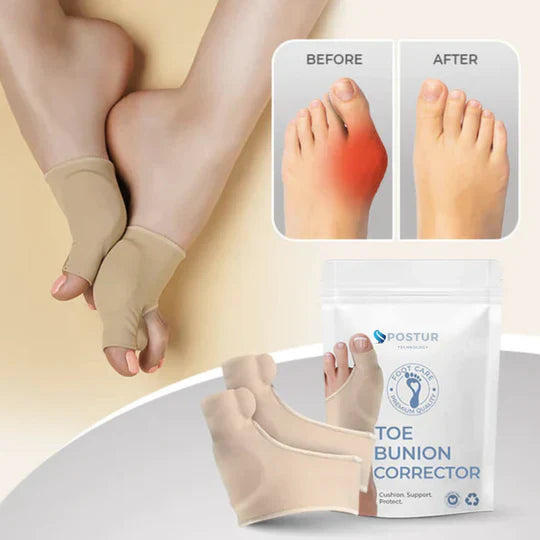 Hallux Valgus Teen Corrector | Orthopedische Bunion Spalk | Zachte Gel | 1 Paar