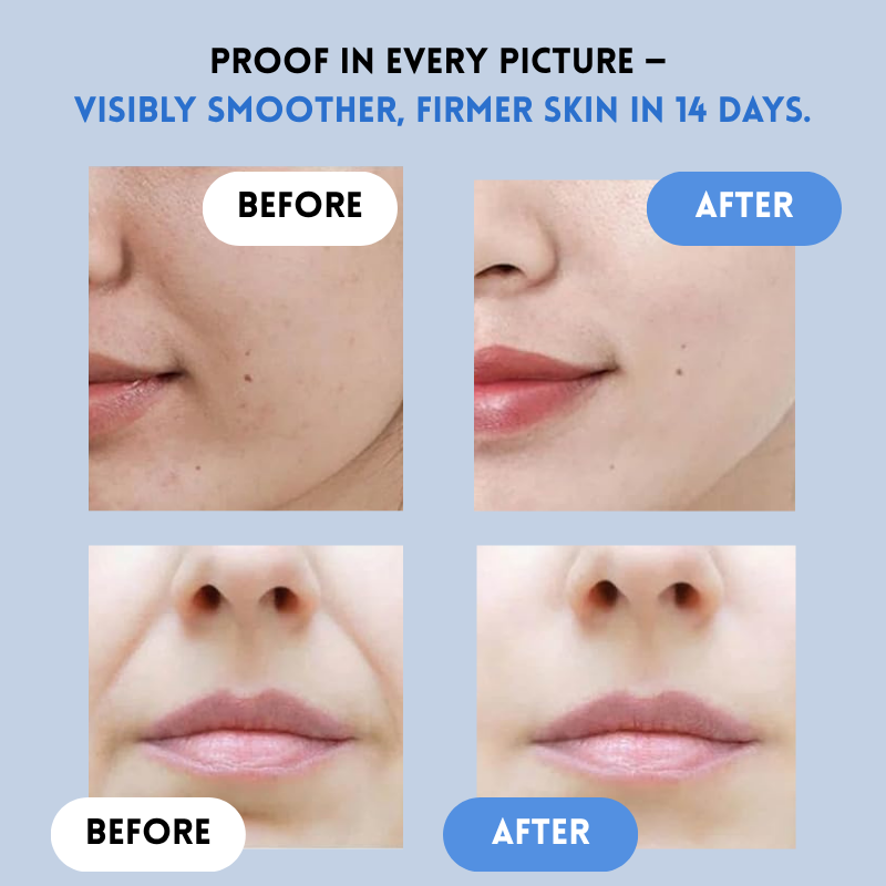 JeugdLift™ Onmiddellijk Jeugdig Liftend