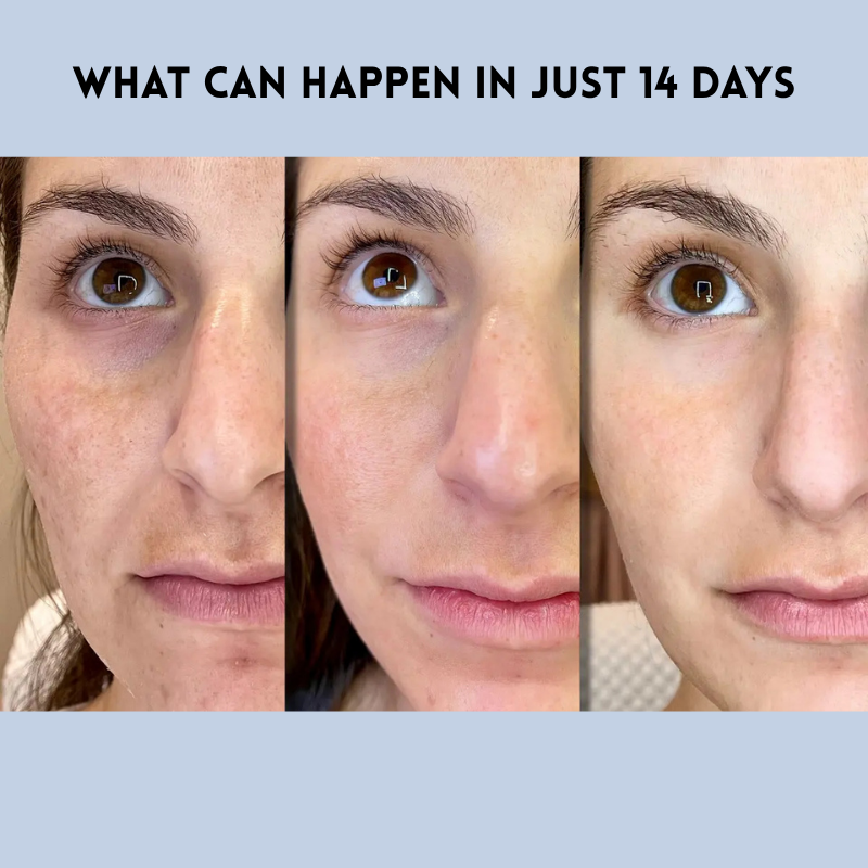 JeugdLift™ Onmiddellijk Jeugdig Liftend