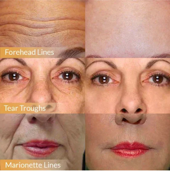 Anti-Aging Gezichtscrème | Japanse Formule | Lifting, Hydratatie & Rimpelvermindering
