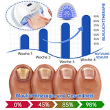 SchimmelVrij™ Vernieuw de nagelgezondheid in slechts enkele weken