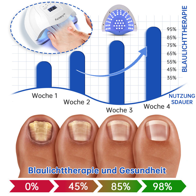 SchimmelVrij™ Vernieuw de nagelgezondheid in slechts enkele weken