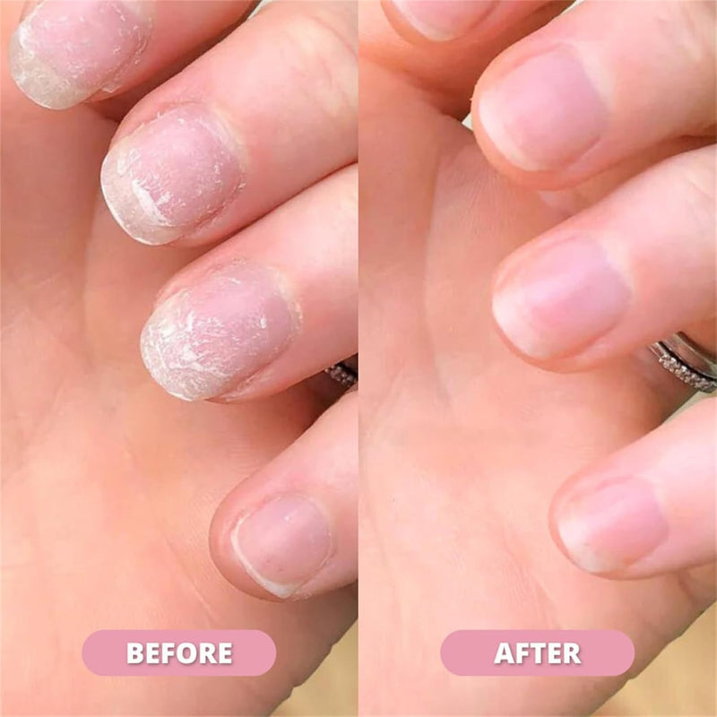 Nagelgroei Olie | Voedend & Verstevigend Serum | Hydraterende Formule
