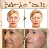 Anti-Aging Gezichtscrème | Japanse Formule | Lifting, Hydratatie & Rimpelvermindering