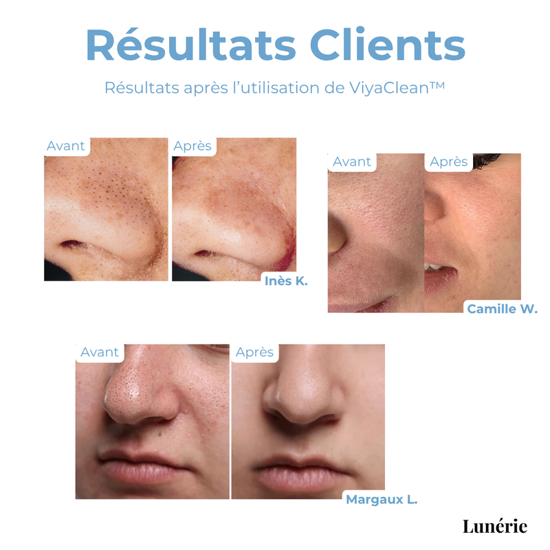 ZuiverendSerum™ Diep Reinigend Serum