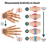 OrthoHulp™ Crème voor gewrichts- en bottherapie