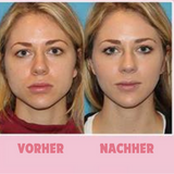 GezichtStraler™ Gezichtsserum | Verstevigend & Verjongend Effect | Anti-Aging Hydratatie voor Stralende Huid