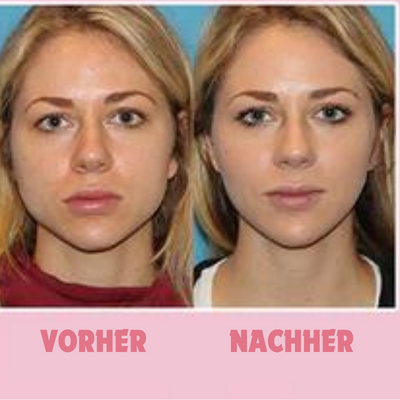 GezichtStraler™ Gezichtsserum | Verstevigend & Verjongend Effect | Anti-Aging Hydratatie voor Stralende Huid