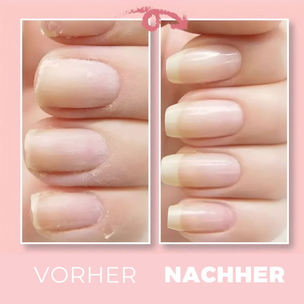 ZimYourNails™ Repair Gel voor gezonde nagels (1+1 GRATIS)