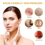 SlakkenGlow™ Perfecte Huid Detox