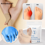 BunionGuard™ Orthopedische Hallux Valgus Bunion Correctie