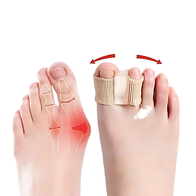 Toe Separatoren | Elastisch & Hautfreundlich | Schmerzreduktion bei Ballenzehen & Fehlstellungen