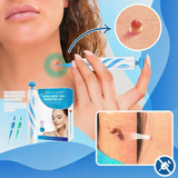 Huidlabel Verwijderingsset | SkinTag | Veilig & Effectief | Voor Thuisgebruik