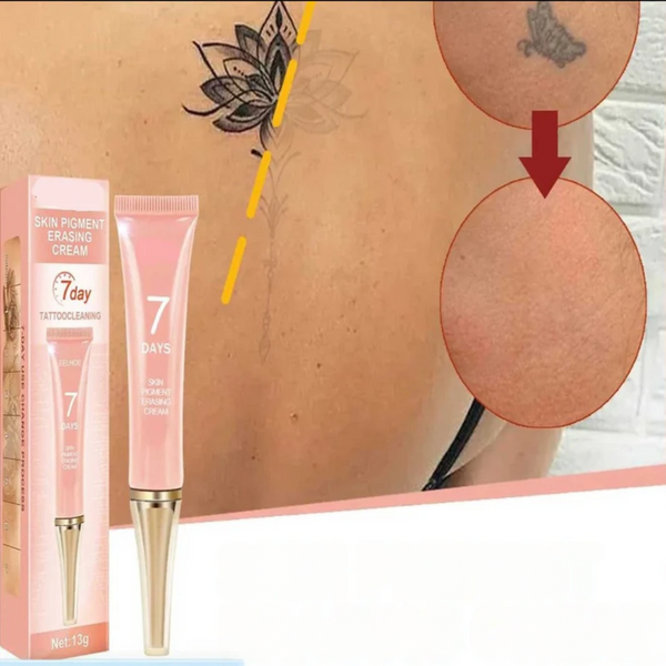 DermErase Tattoo Verwijder Crème | Vervaagt Tattoos | Zachte Huidverzorging