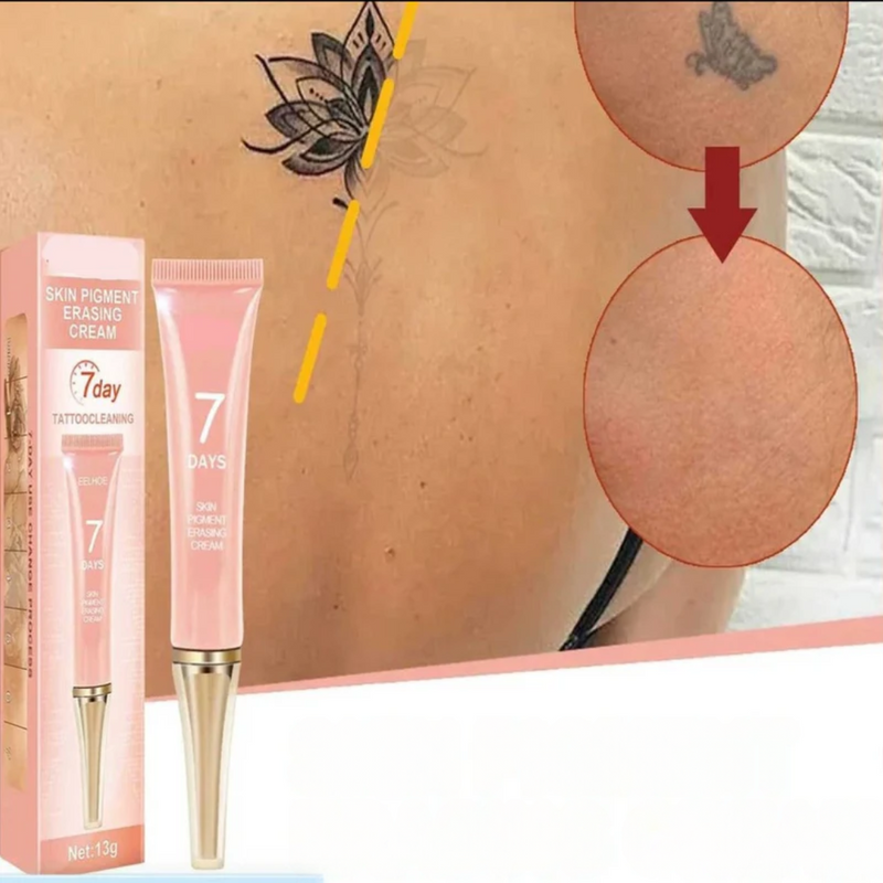 DermErase Tattoo Verwijder Crème | Vervaagt Tattoos | Zachte Huidverzorging
