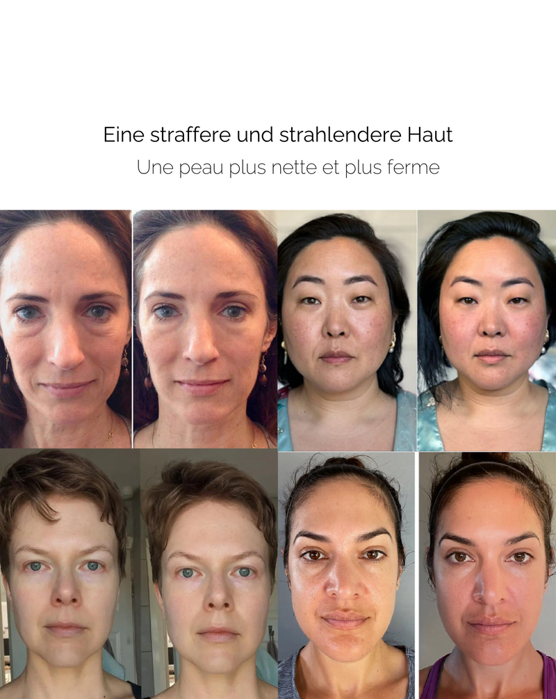 GezichtHerstel™ Stralende Huidroller