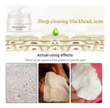 Blackhead Verwijder Pleisters | Poriën Reinigend | Met Aloe Vera & Actieve Kool