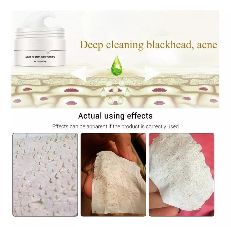 Blackhead Verwijder Pleisters | Poriën Reinigend | Met Aloe Vera & Actieve Kool