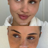 SpikkelAanraking™ Speelse Schoonheid Accent