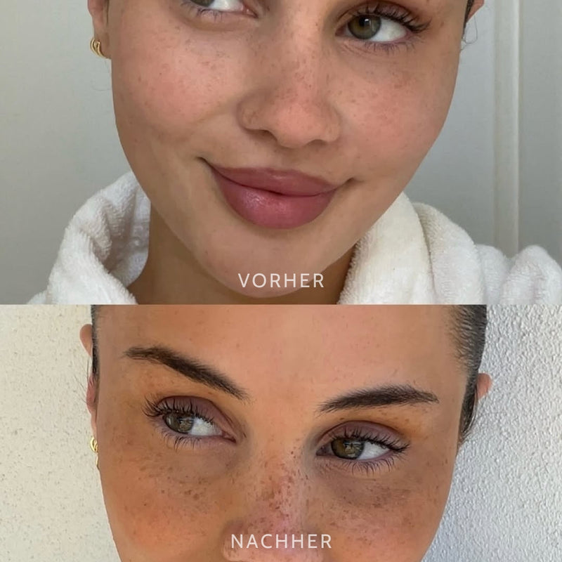 SpikkelAanraking™ Speelse Schoonheid Accent