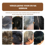 HaarVernieuwen™ Verbetert de gezondheid van het haar