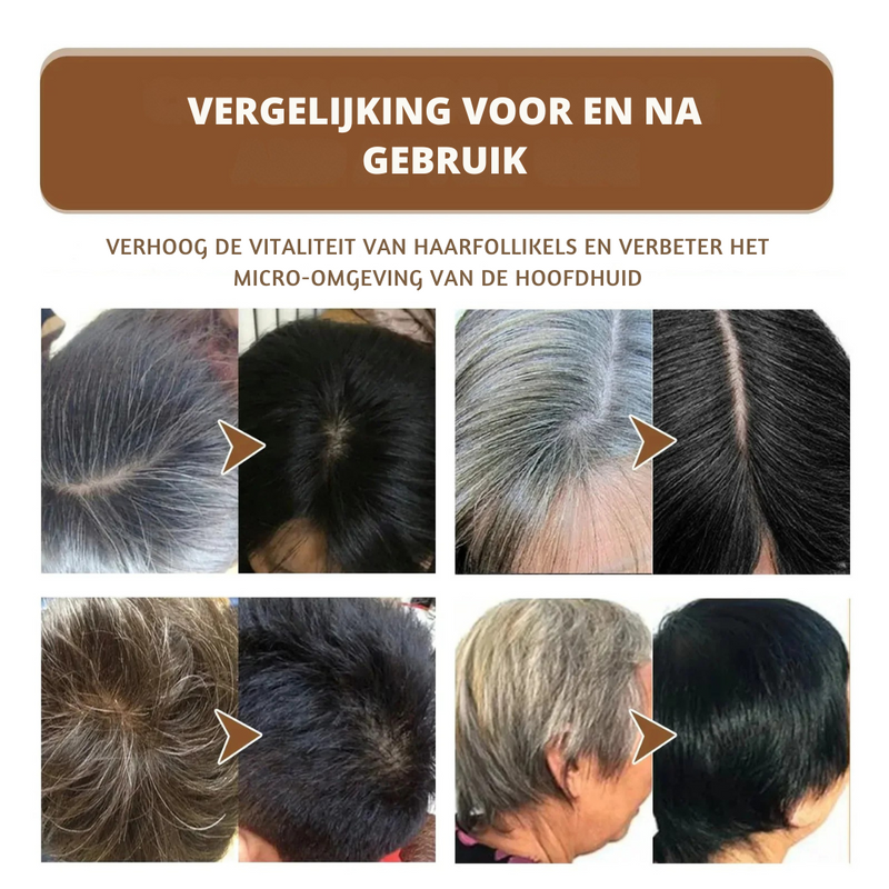 HaarVernieuwen™ Verbetert de gezondheid van het haar