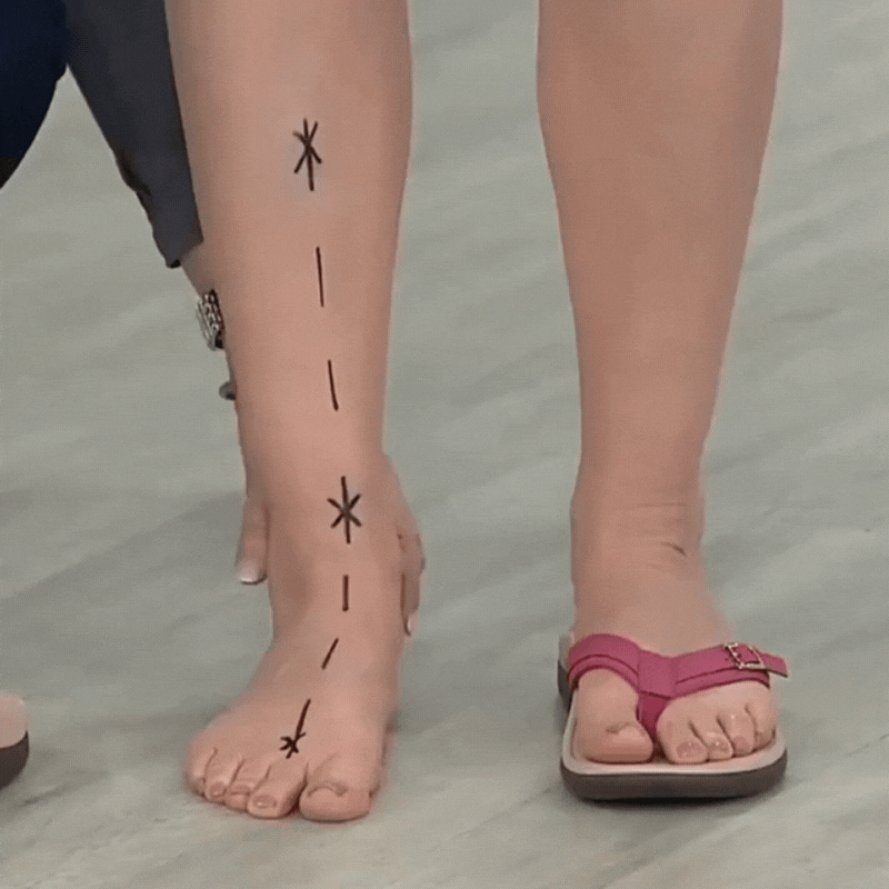 Aubrey™ - Orthopedische Zomersandalen