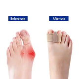 Toe Separatoren | Elastisch & Hautfreundlich | Schmerzreduktion bei Ballenzehen & Fehlstellungen