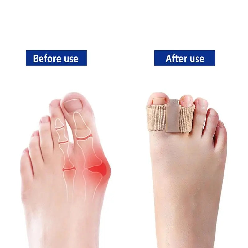 Toe Separatoren | Elastisch & Hautfreundlich | Schmerzreduktion bei Ballenzehen & Fehlstellungen