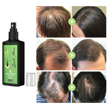 HairGrowth™ | Voedende Gemberspray