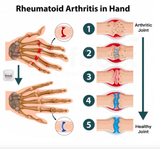 FlexiCrème™ Gewrichts- en bottherapiecrème