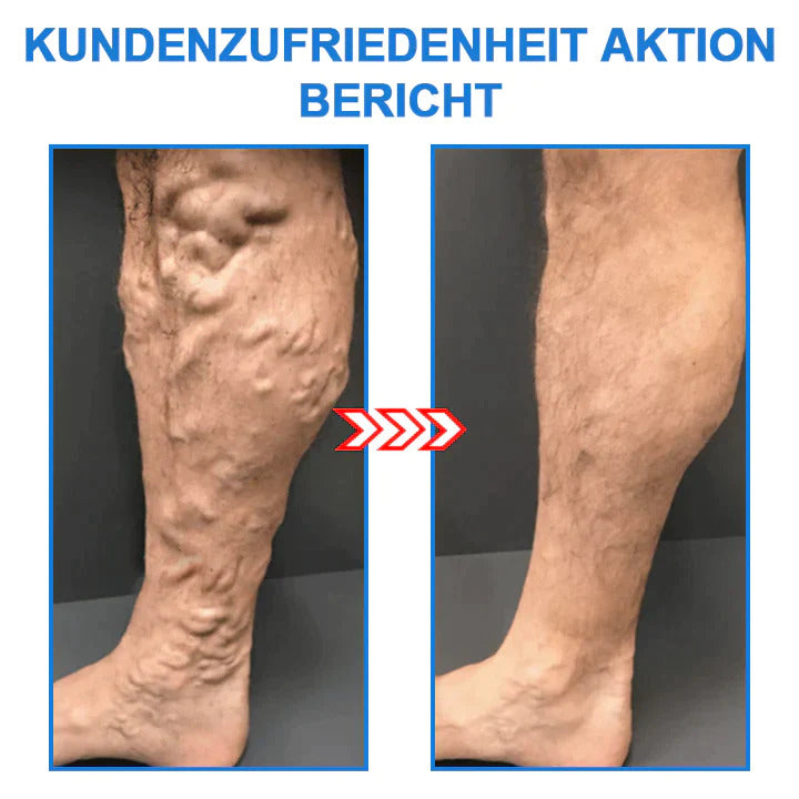 FormFit™ | Gebeeldhouwde benen en een strakke huid