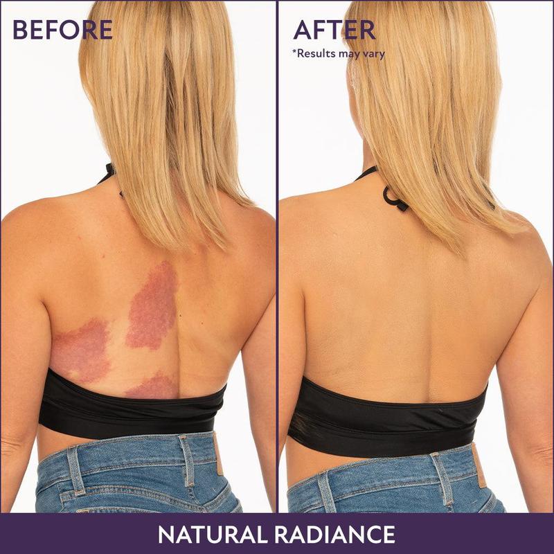 BodyGlow Body Perfector | Waterproof | 24u Dekking & Natuurlijk Stralende Huid