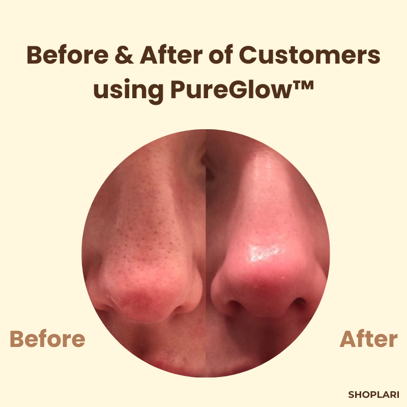 1+1 Gratis | Gezichtsmasker | Zwarte Thee & Ginseng | Tegen Acne, Rimpels & Huidoneffenheden