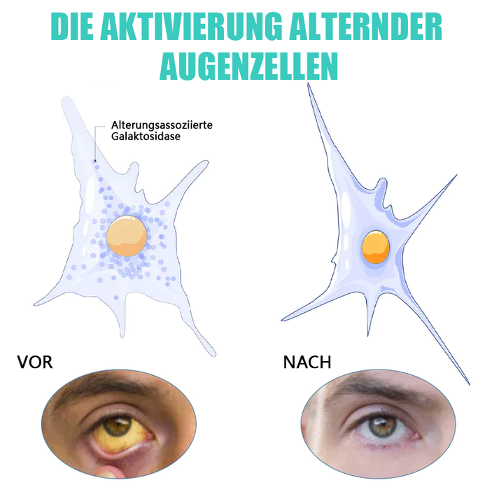 OogHerstel™ Verjongende Oogbehandeling