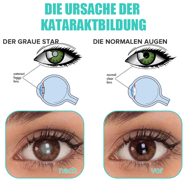 OogHerstel™ Verjongende Oogbehandeling