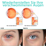 OogHerstel™ Verjongende Oogbehandeling