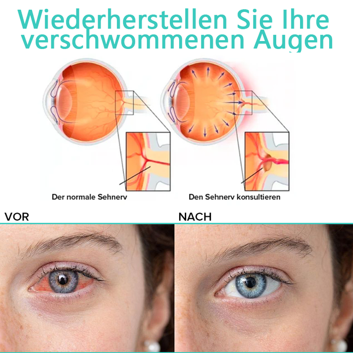 OogHerstel™ Verjongende Oogbehandeling