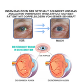 OogHerstel™ Verjongende Oogbehandeling
