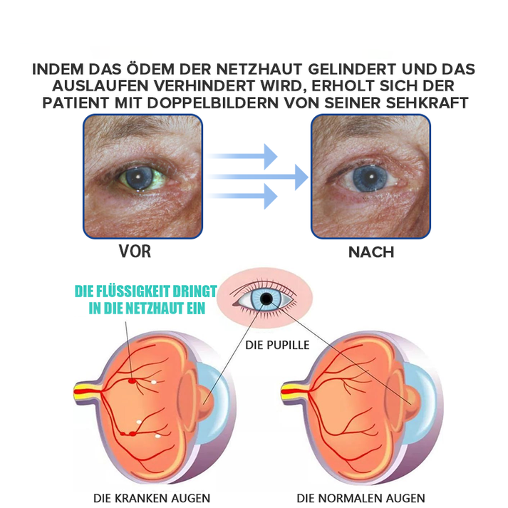 OogHerstel™ Verjongende Oogbehandeling