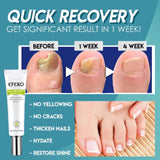 NailRecovery™ | Snel en effectief resultaat!