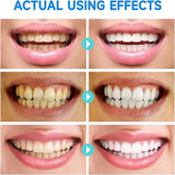 Whitening Tandpasta | Frisse Adem & Gezond Tandvlees | Natuurlijk Wittere Tanden